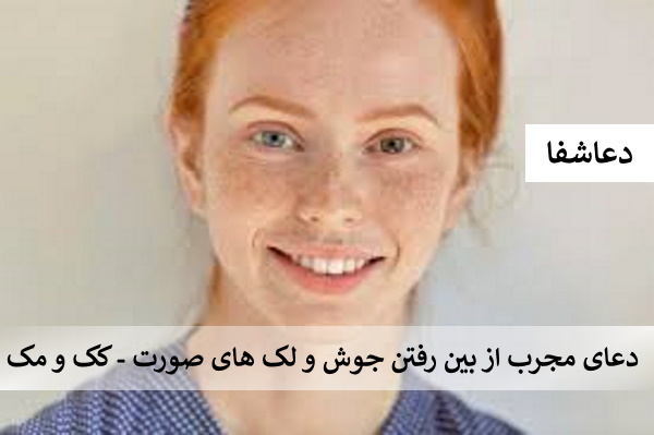 2 دعای مجرب از بین رفتن جوش و لک های صورت - کک و مک  