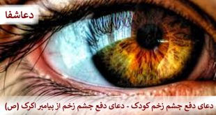 چشم-زخم9-310x165 دعای دفع چشم زخم کودک - دعا دفع چشم زخم از پیامبر اکرم (ص)  