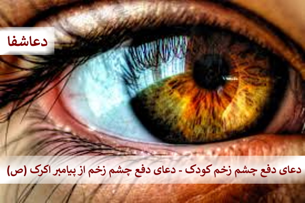 چشم-زخم9 دعای دفع چشم زخم کودک - دعا دفع چشم زخم از پیامبر اکرم (ص)  