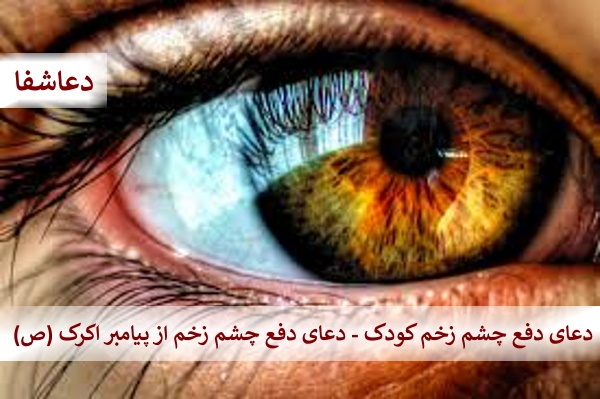 -زخم9 دعای دفع چشم زخم کودک - دعا دفع چشم زخم از پیامبر اکرم (ص)  