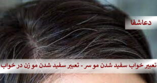 سفید2-310x165 تعبیر خواب سفید شدن موی سر - تعبیر سفید شدن مو  زن در خواب  